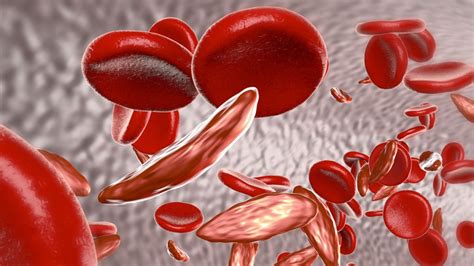 poikilocytosis symptoms|Poikilocytosis: Symptoms, Causes, Treatment .